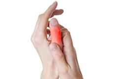 Finger Sprain
